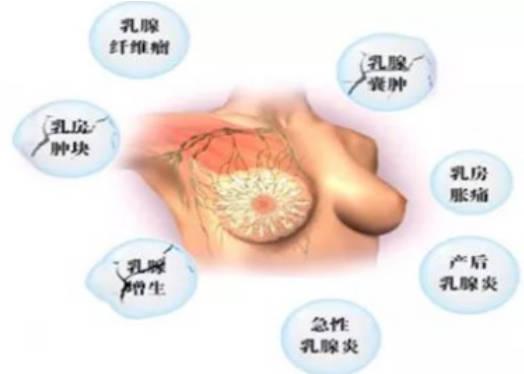 乳腺腫塊治療方式有哪些？