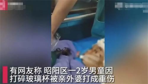 2歲男童因打碎玻璃杯遭外婆暴力毆打，生命岌岌可危