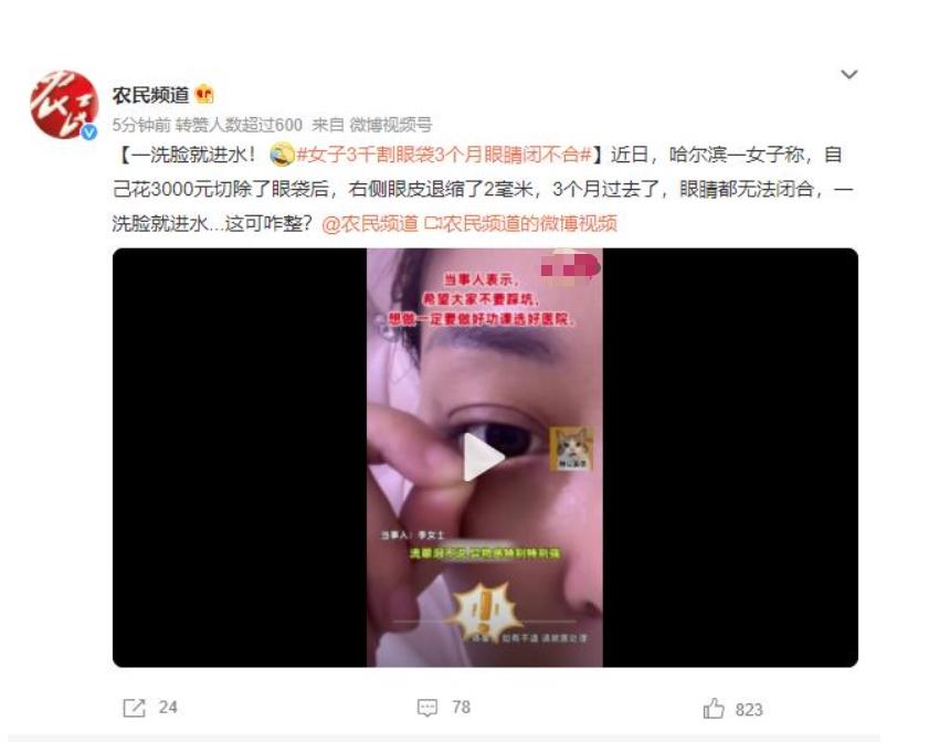 眼袋手術(shù)后3個月眼睛閉不合，女子苦惱洗臉進(jìn)水該如何解決？